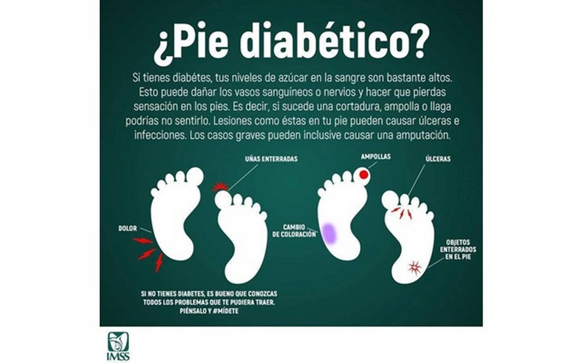 IMSS emite para cuidado de pie diabético noticias de